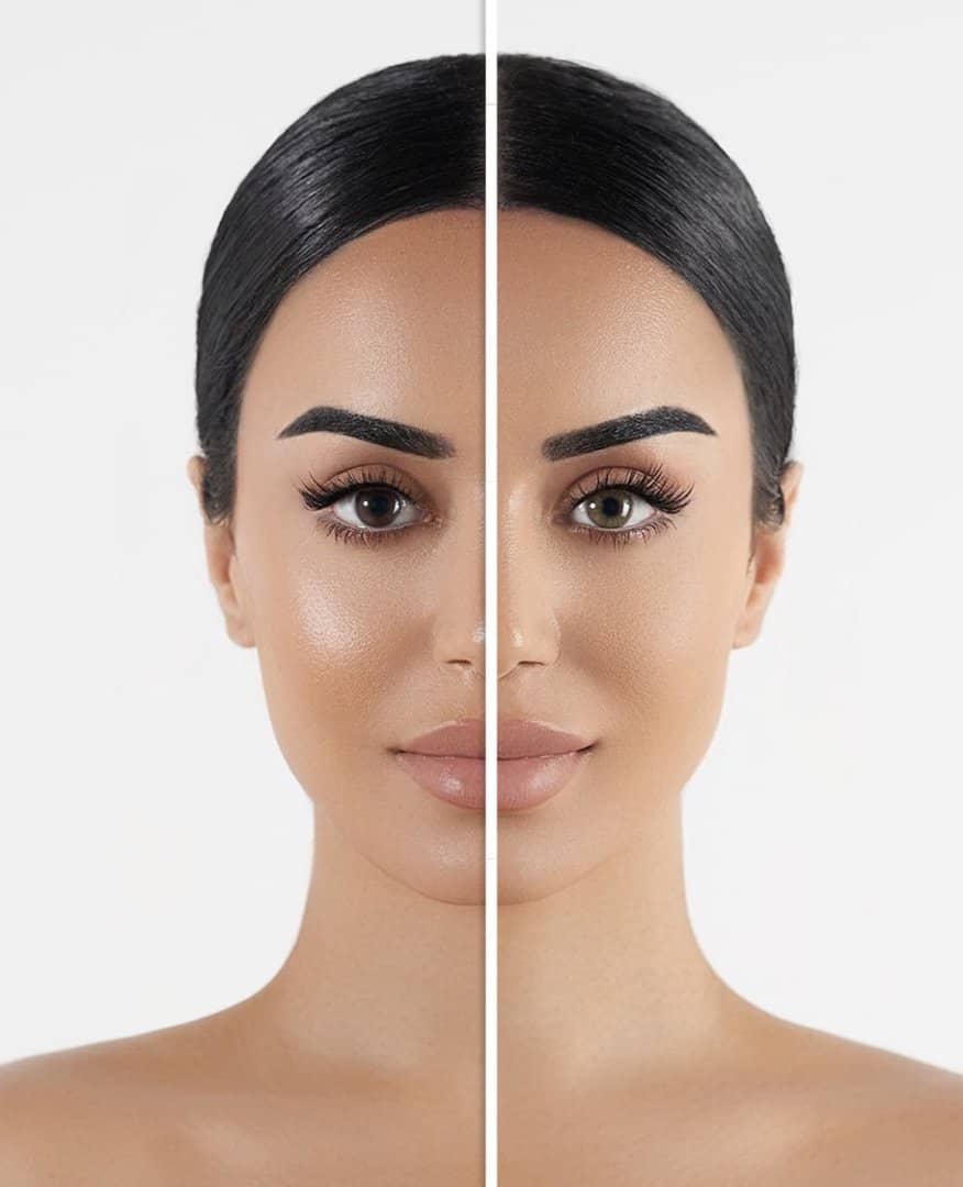 Ilo | Lenses